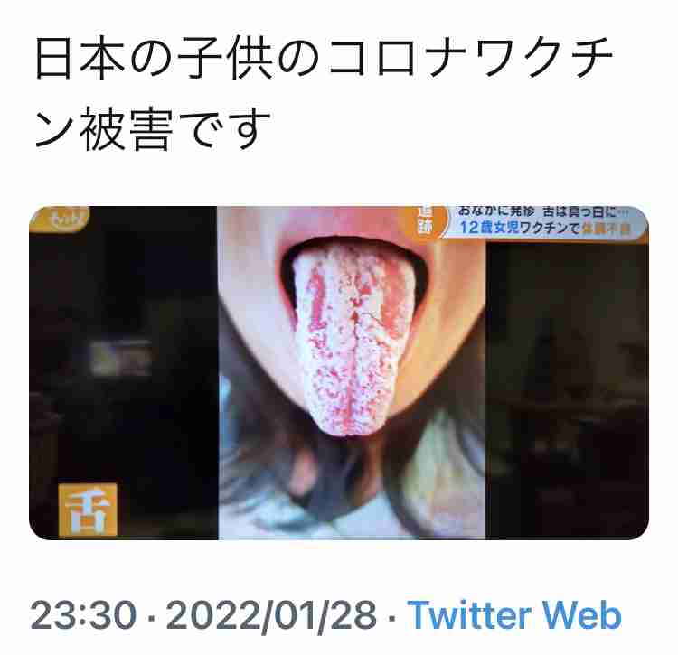 副反応でも過半数休まず　コロナワクチン、解熱剤服用で出勤も