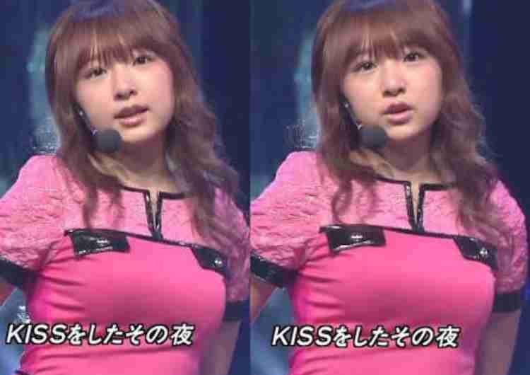 加護亜依　顎関節症を告白「口がなかな開けません。ぴえん」にフォロワーも心配の声