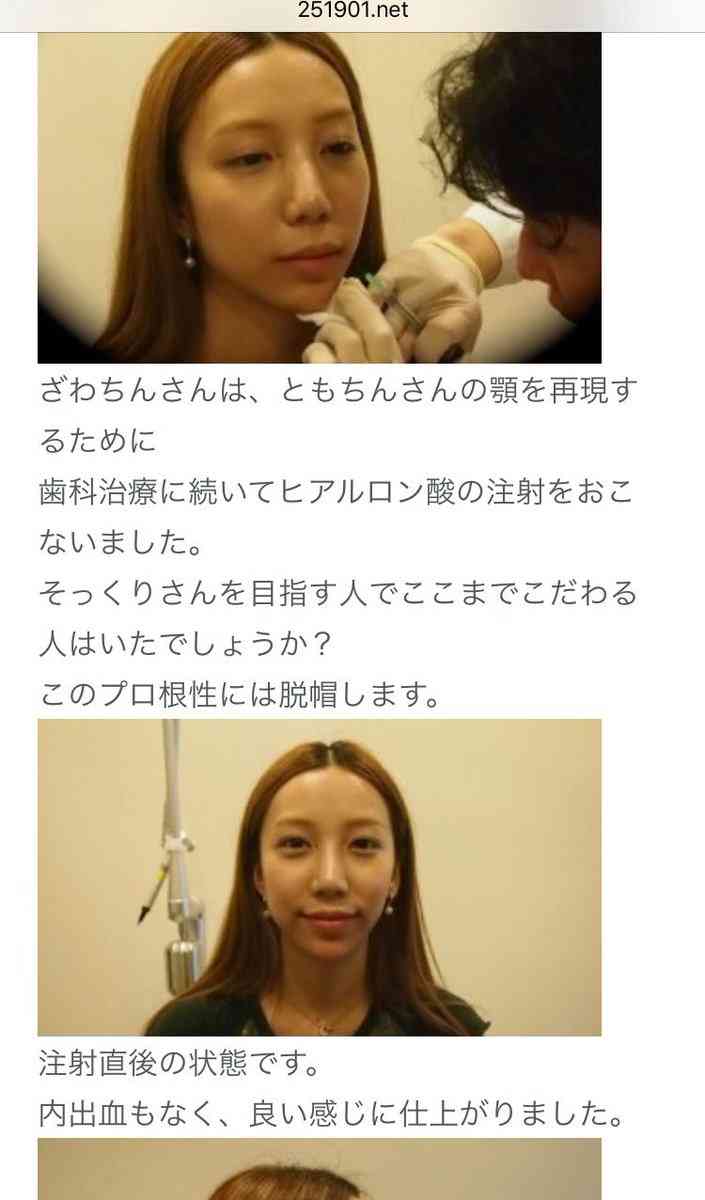 ざわちん、ボディコン姿を公開…「少し太り気味」と反省も「めちゃめちゃスタイルいい」の声