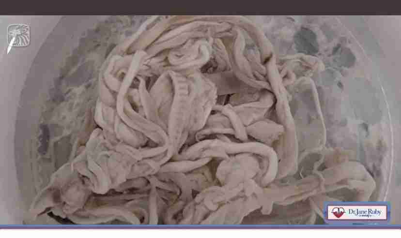 41歳夫が驚愕、「ワクチンを打つと死ぬ」と信じた妻の「暴走」…やがて別居婚へ