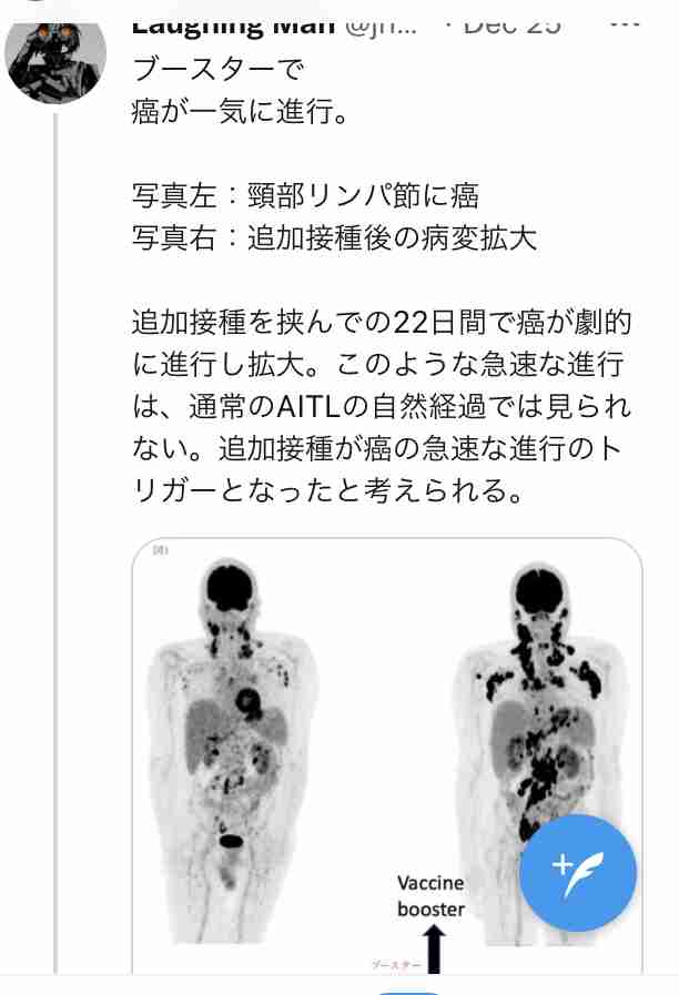 41歳夫が驚愕、「ワクチンを打つと死ぬ」と信じた妻の「暴走」…やがて別居婚へ