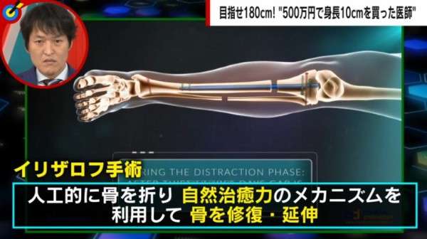 プロゲーマーたぬかなの〝問題発言〟を所属チームが謝罪　レッドブルは公式サイトから削除