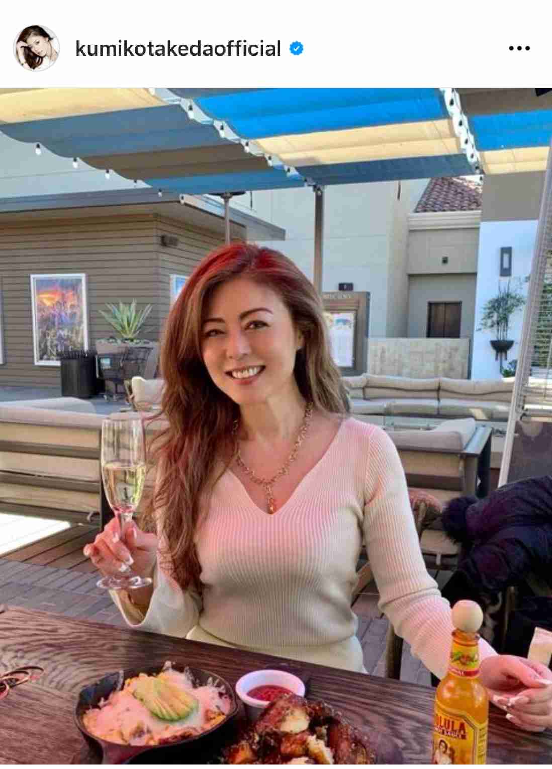 武田久美子に「なぜ歳取らない」「美魔女」 貝殻ネックレス姿も反響「世界で一番似合う」