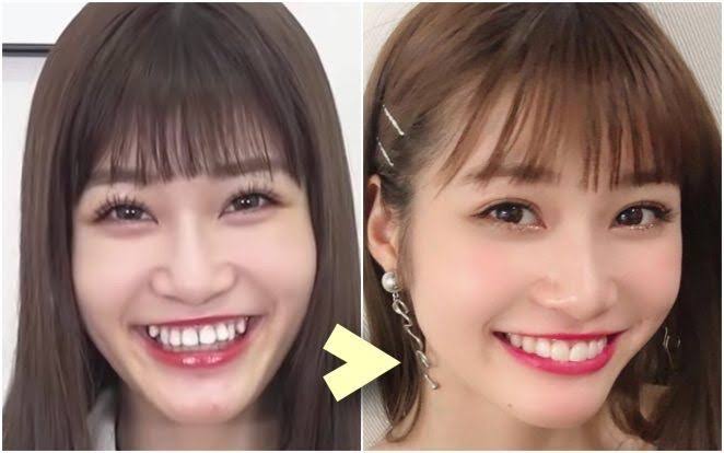 “めるる”生見愛瑠、三つ編み『メガネっ娘』スタイルに「透明感やばぃ」と歓声「めちゃくちゃ新鮮」