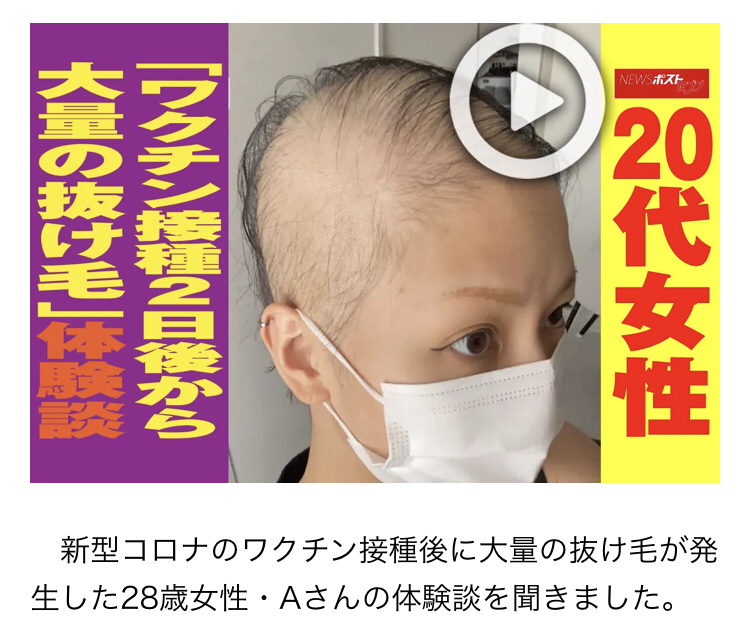 接種後に「熱出た人ほどワクチン効果高い」　九大病院など発表