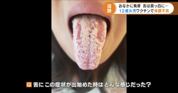 【雑談】3回目のコロナワクチン打った人