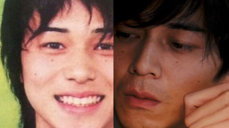 顎にボトックス注入した女性、頬袋に餌を蓄えたハムスターのような顔に（豪）