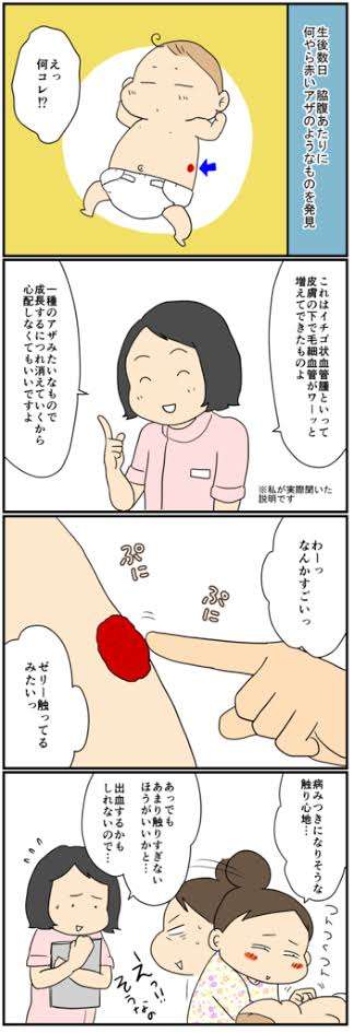 生まれつき顔に赤いあざのある赤ちゃん　「虐待を疑われたことも」と母親（英）
