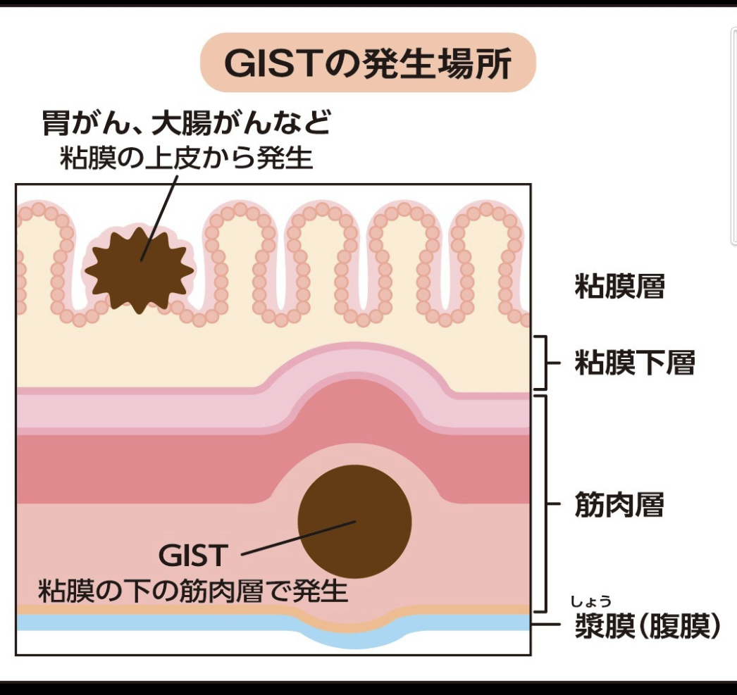 体の不調を放置してる人