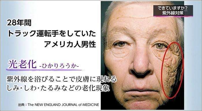 フェイスラインのたるみを防ぐ方法