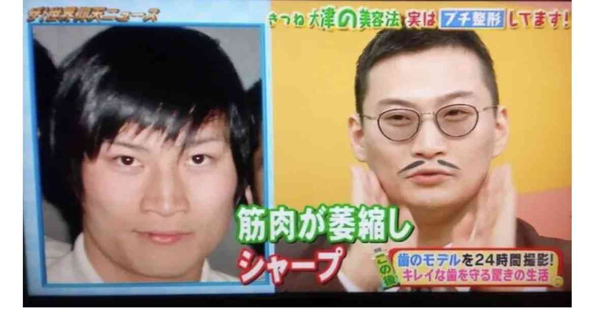 きつね大津　壮絶幼少期「父親が3億円ぐらい借金背負って失踪」　女手一つで育ててくれた母の現在