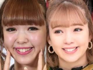 顔の肉を取る方法が知りたい！