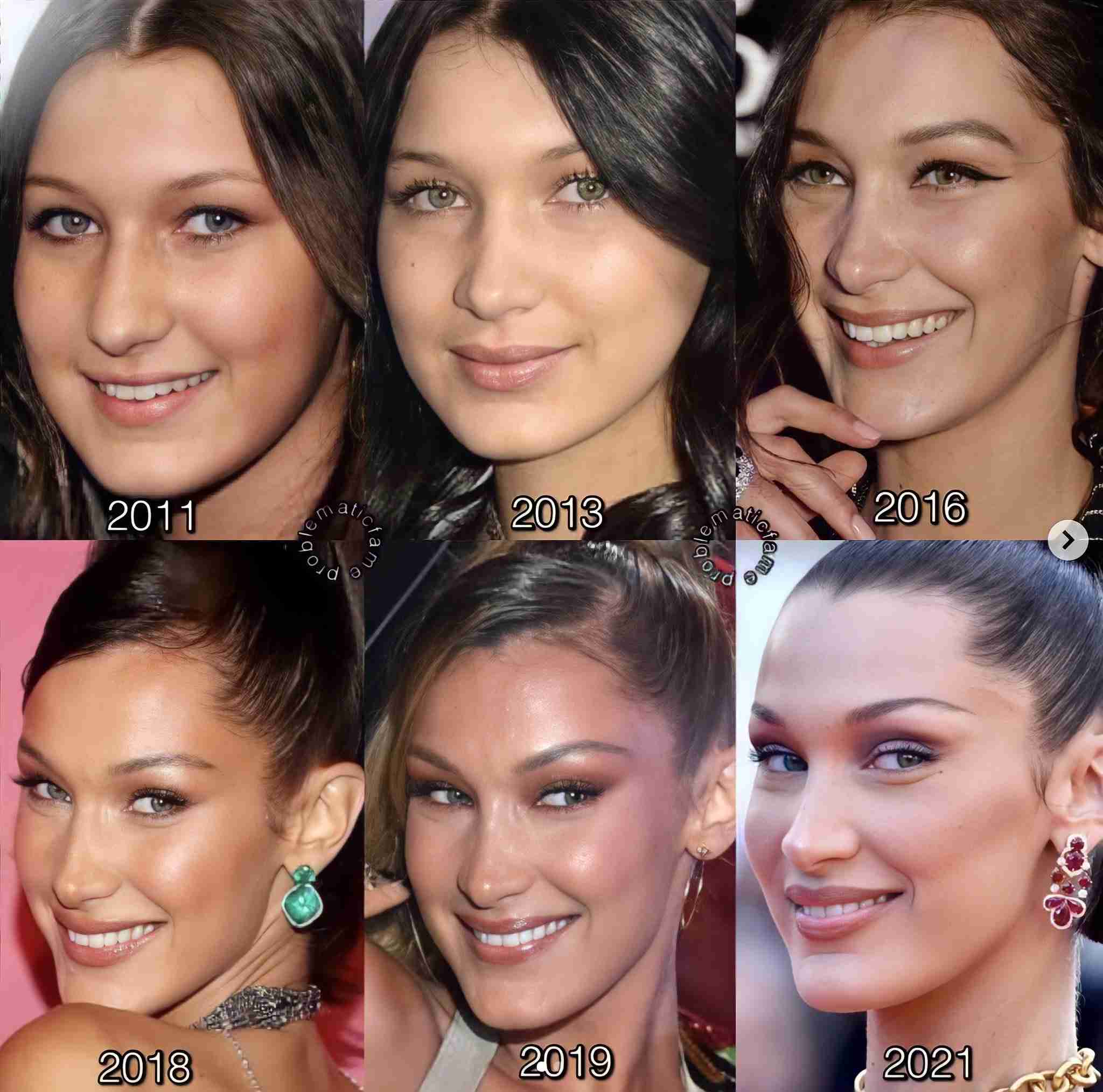 Bellathadoll: Before And After - chsdi2n