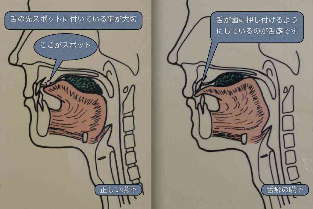 舌の位置がわからない