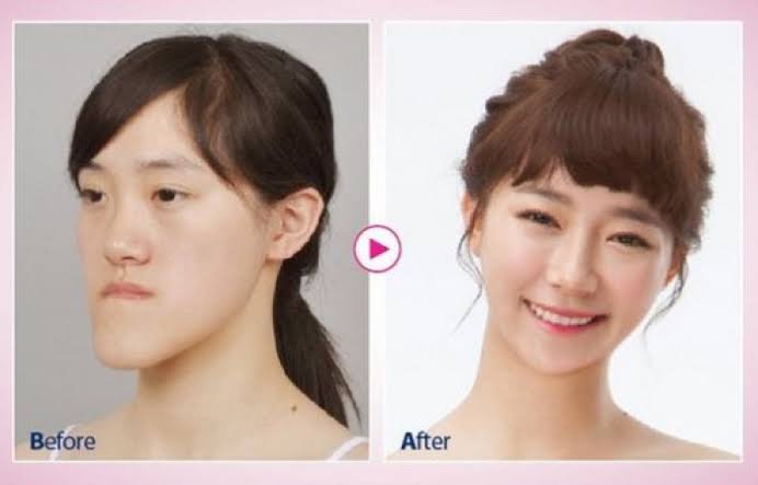 【痩せてもブス】ダイエットのやる気が起きない