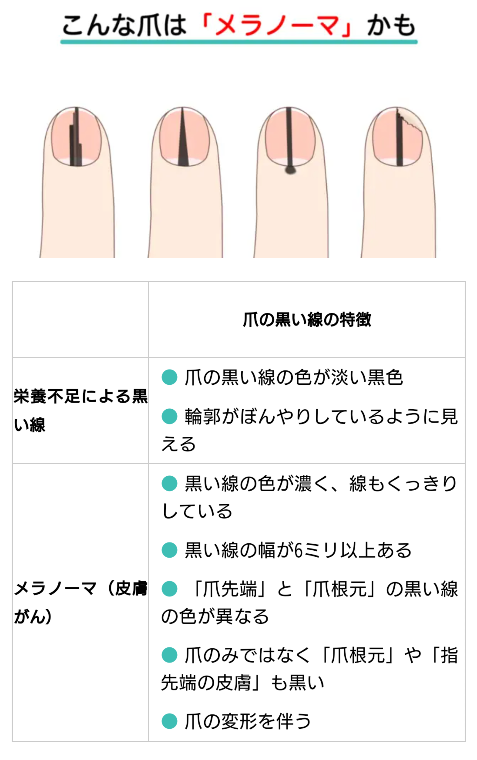10年前から爪にあった線が皮膚がんと判明した女性「心配な人は皮膚科医に診てもらって」（米）