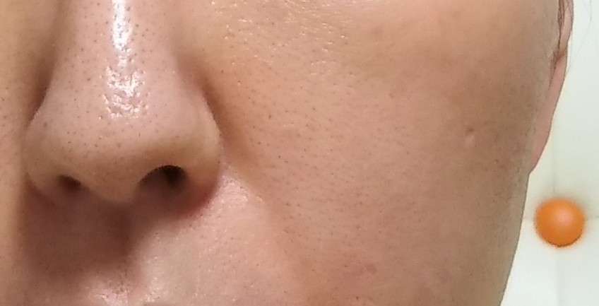 毛穴の開きが気になる