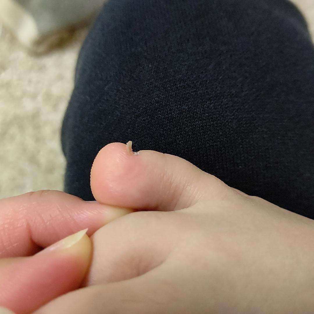 悩んでる症状を書くと何科に行けばいいか親切な人が教えてくれるトピ