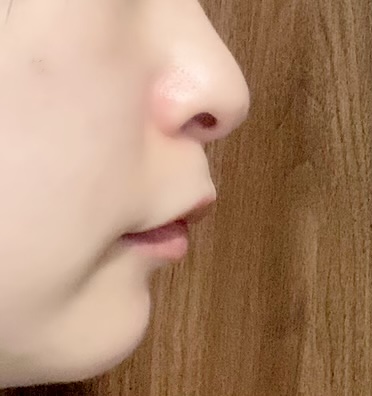 歯の矯正をして後悔してる人