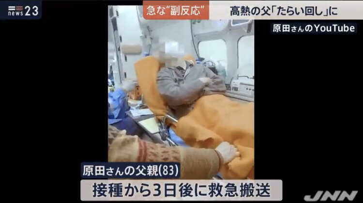 「帯状ほう疹」患者が急増 3回目接種後に発症した男性(20代)の場合は…