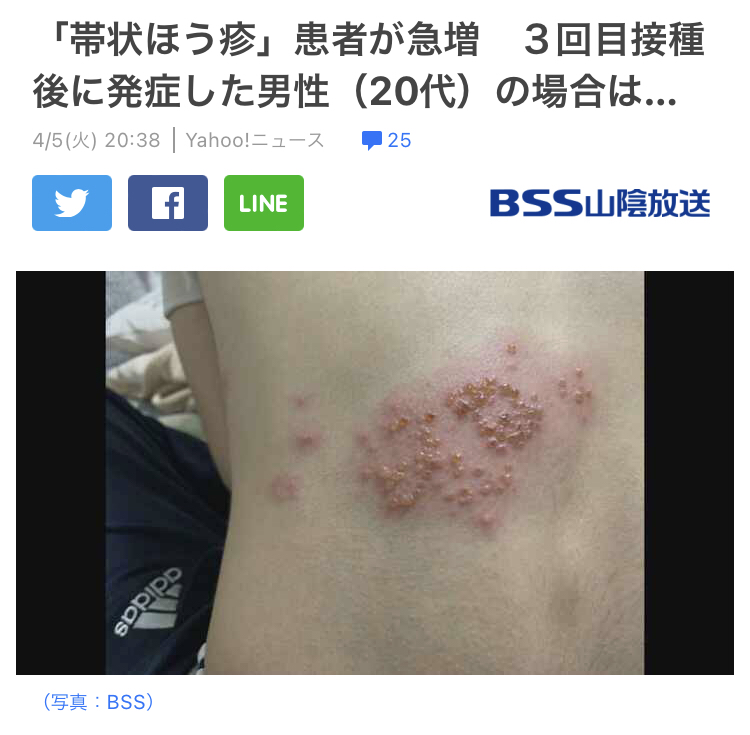 「帯状ほう疹」患者が急増 3回目接種後に発症した男性(20代)の場合は…