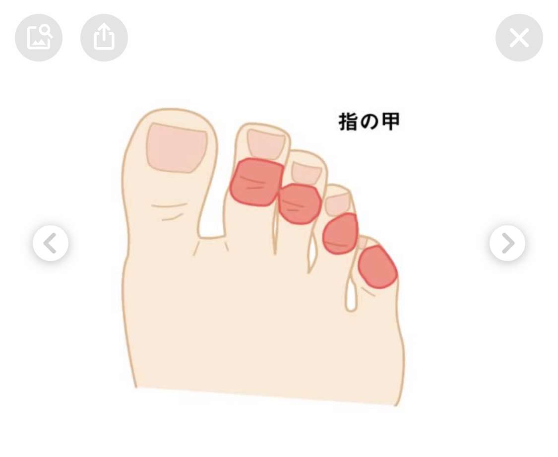 【サンダル】足が痛い