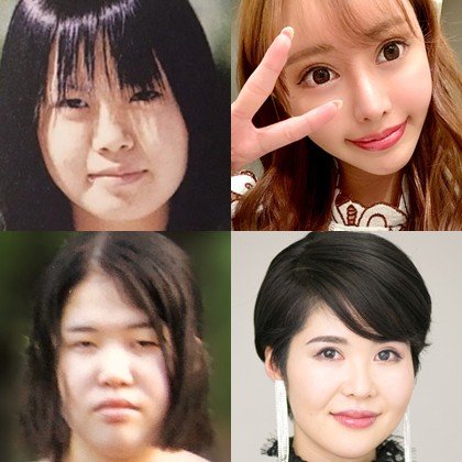 【意識調査】美容整形、女性の約4割が「したいと思ったことがある」施術を考えたパーツは“目”が55.0%