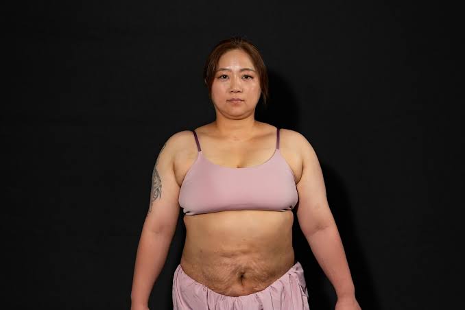 【アラフォー】お腹周りはもうどうにもなりませんか？