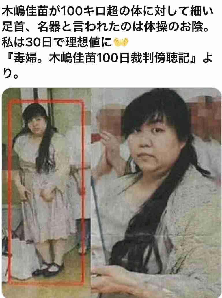 傘の先端部分で61歳女性を突き刺して重傷負わせたか 自称・セラピストの女逮捕