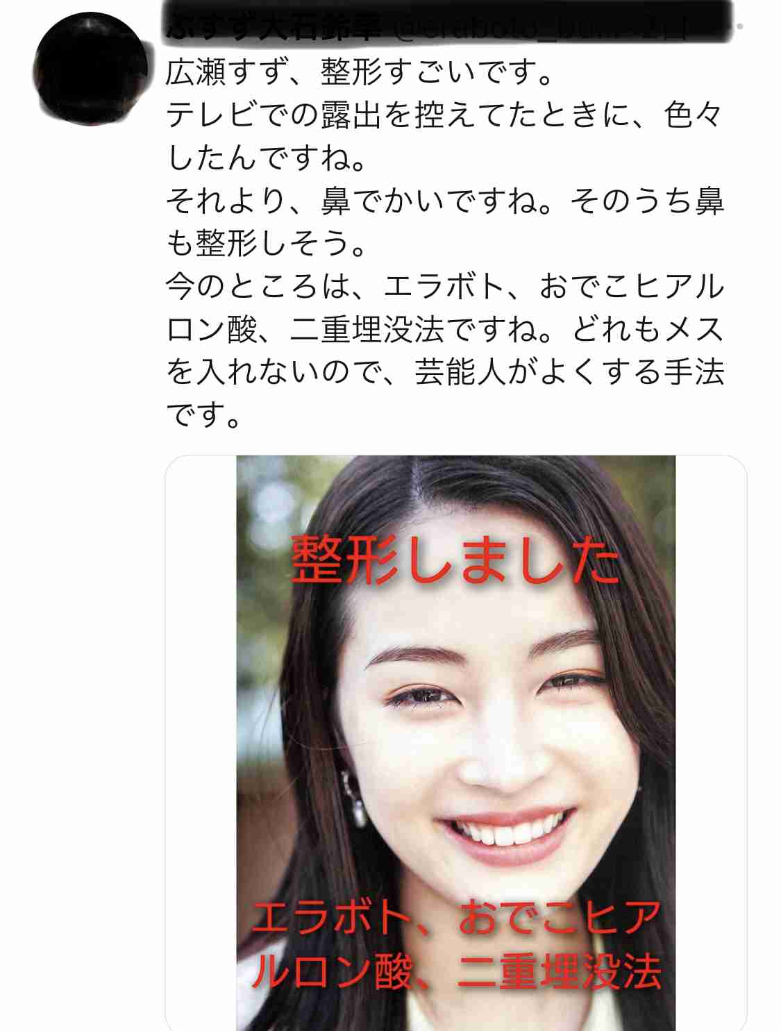 広瀬すず「付き合うとか面倒くさい」「パッて結婚したい」