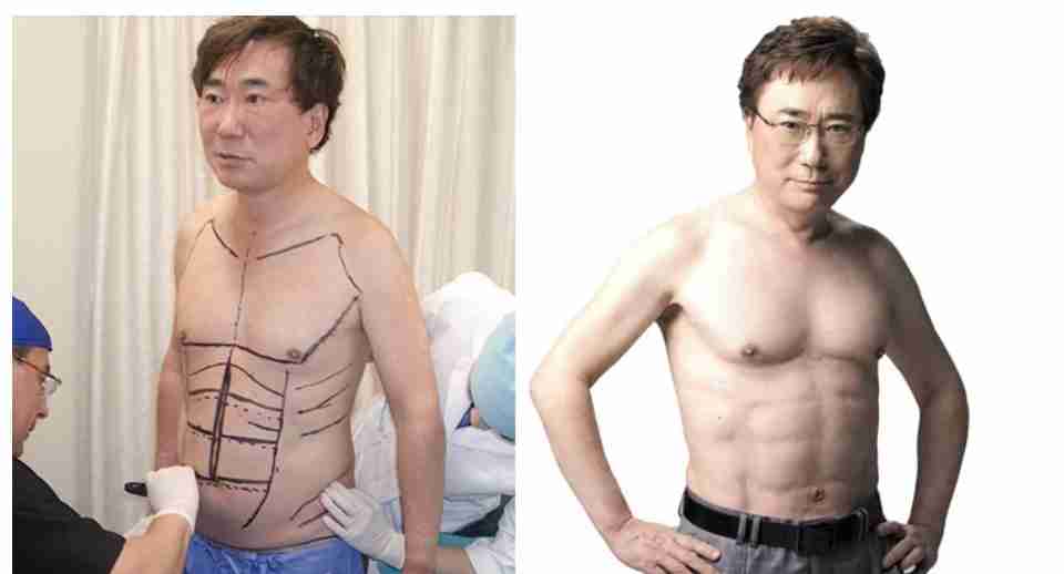 “世界で一番ダサいタトゥー”と大不評！　「ジムに通うのはもう嫌だ」6つに割れた腹筋のタトゥーを入れた男性に賛否両論