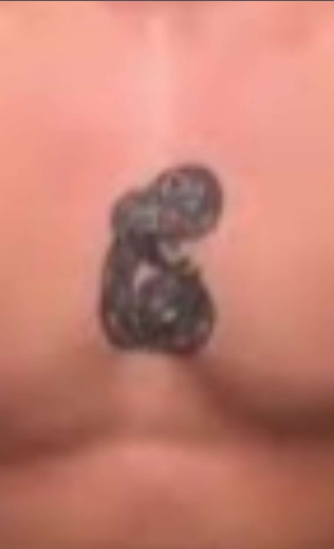 “世界で一番ダサいタトゥー”と大不評！　「ジムに通うのはもう嫌だ」6つに割れた腹筋のタトゥーを入れた男性に賛否両論