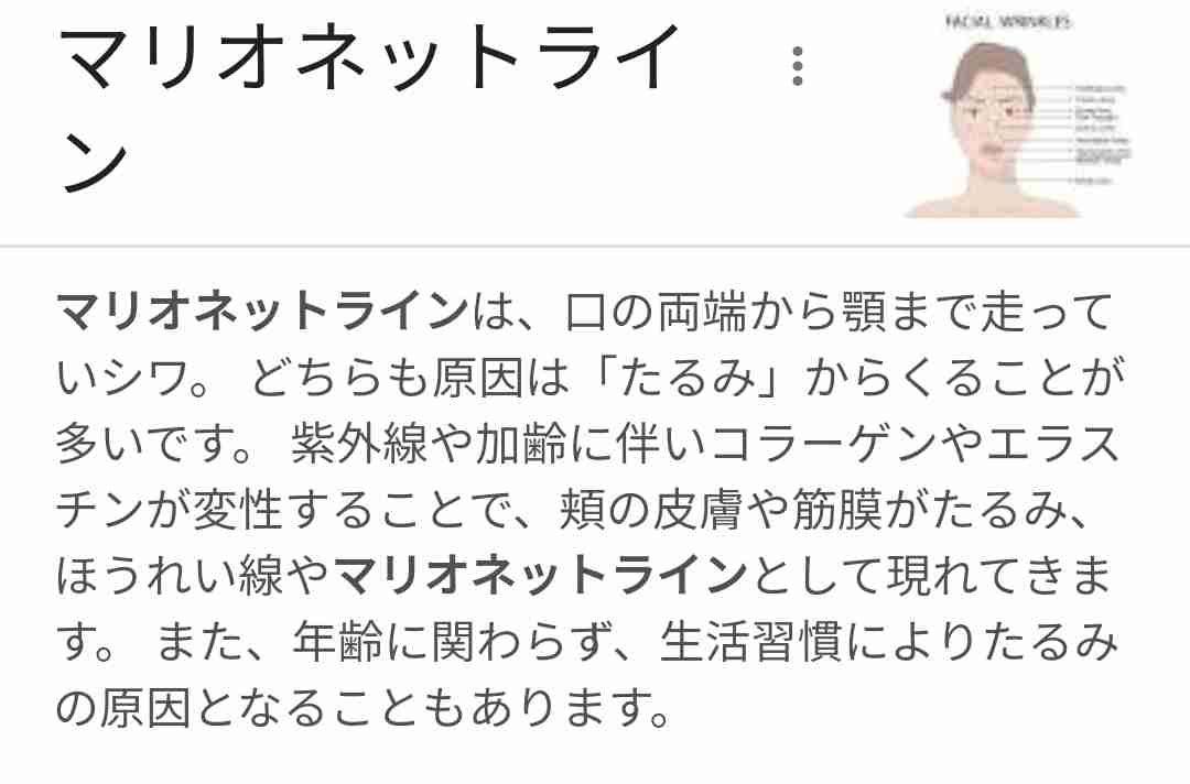 【悲願】にっくきマリオネットライン【消失】