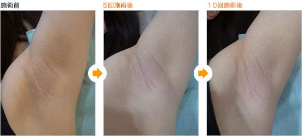 どうして可愛い子は髪質や肌質まで完璧なのか?