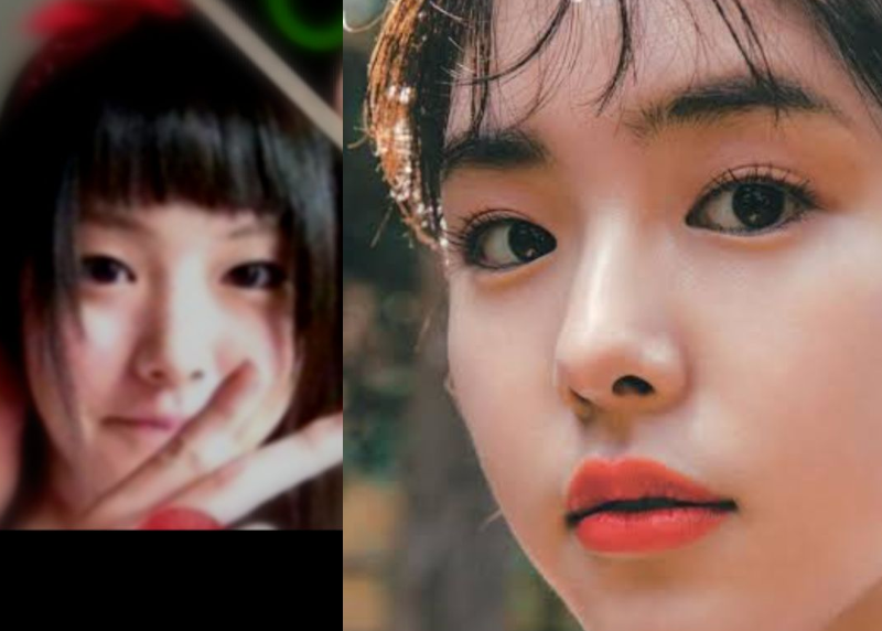 元モー娘。新垣里沙、顔のリフトアップ施術ビフォーアフター公開「自分で撮ってびっくり」