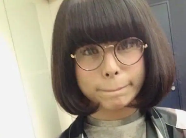 唇の日焼け対策