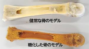 5月ダイエット総合トピ
