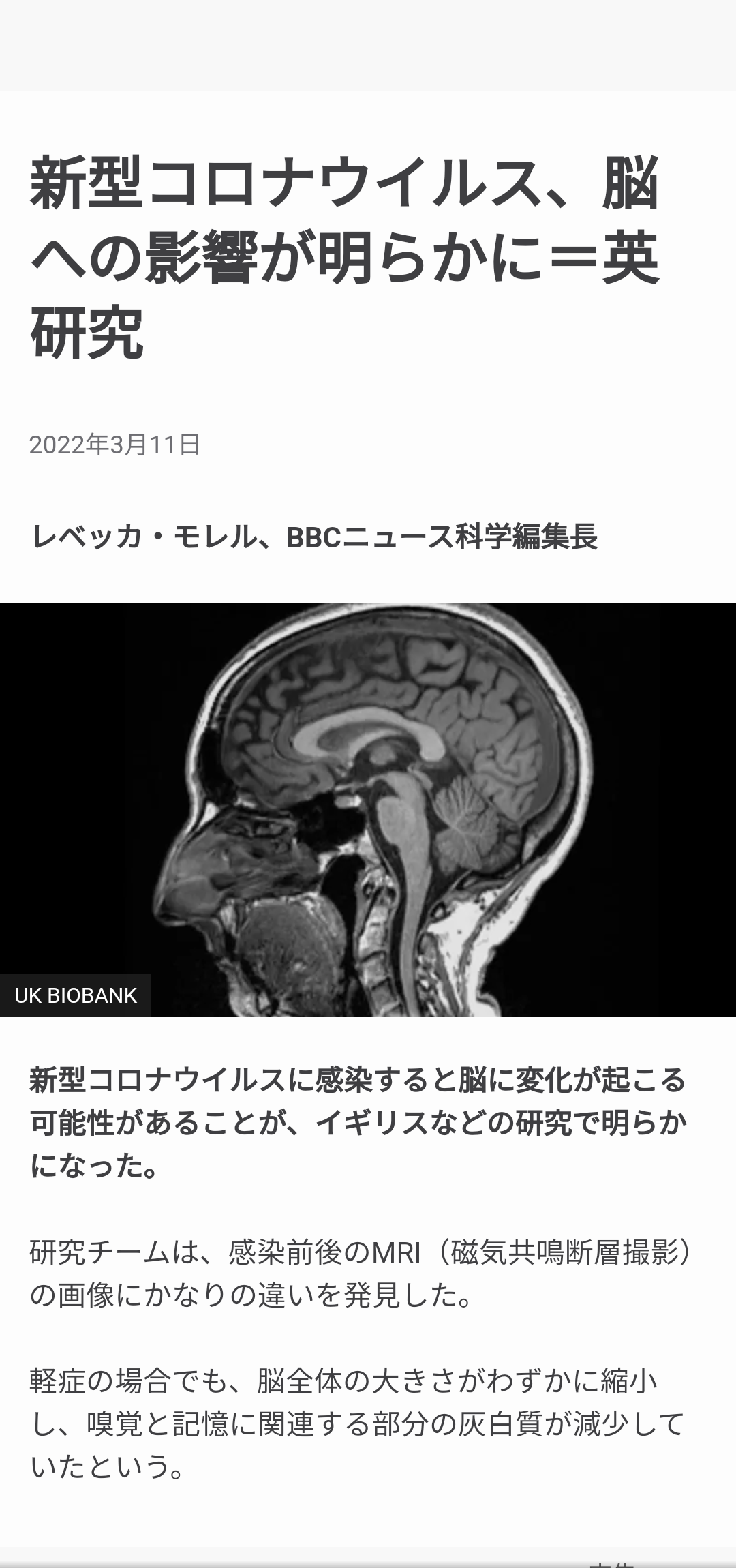 新型コロナ 基礎疾患ない10歳未満の女児死亡 栃木県