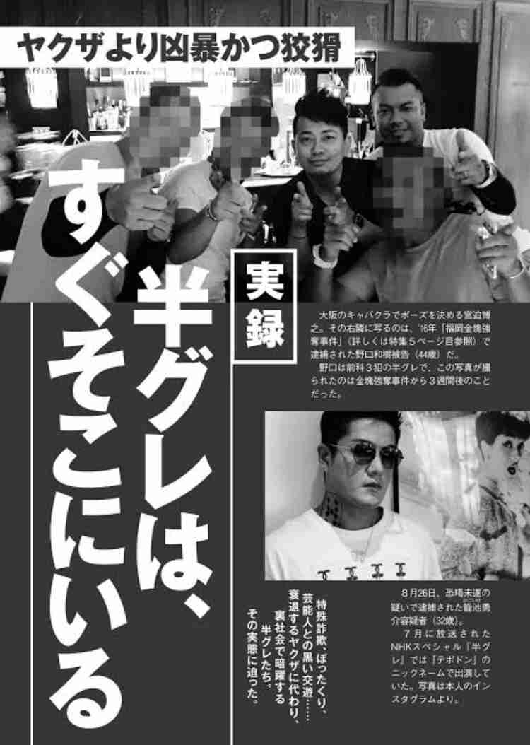 宮迫博之が松本人志との〝関係性〟語る 千原せいじニヤリ「完全に楯突いたな!」