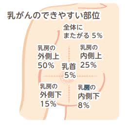 この初期症状→これだった　part4