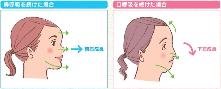 『脱マスク』思いさまざま…「マスク取るの恥ずかしい」「顔を覚えられず」「早く2類相当から5類に」