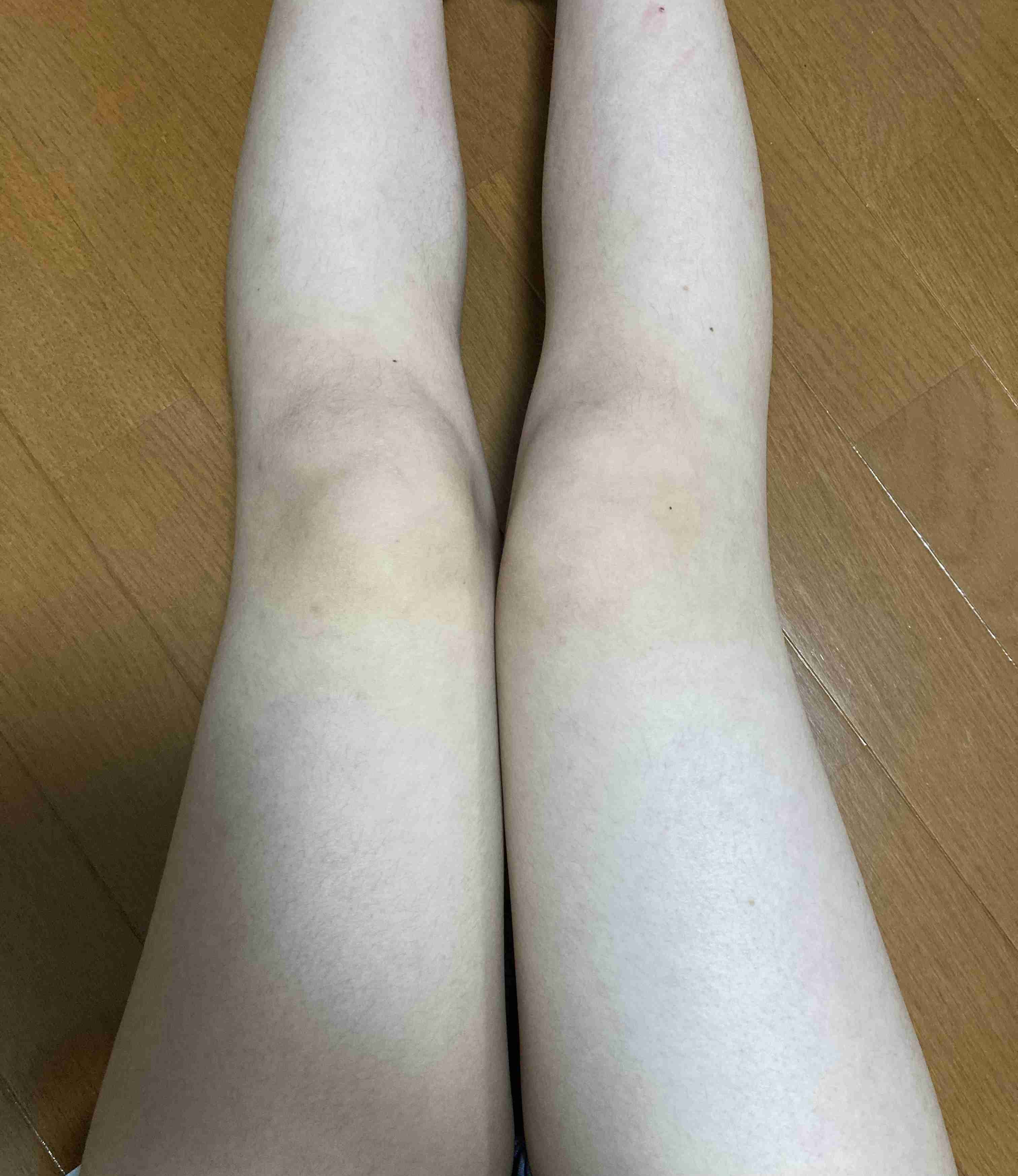 骨格診断をしてもらうトピ