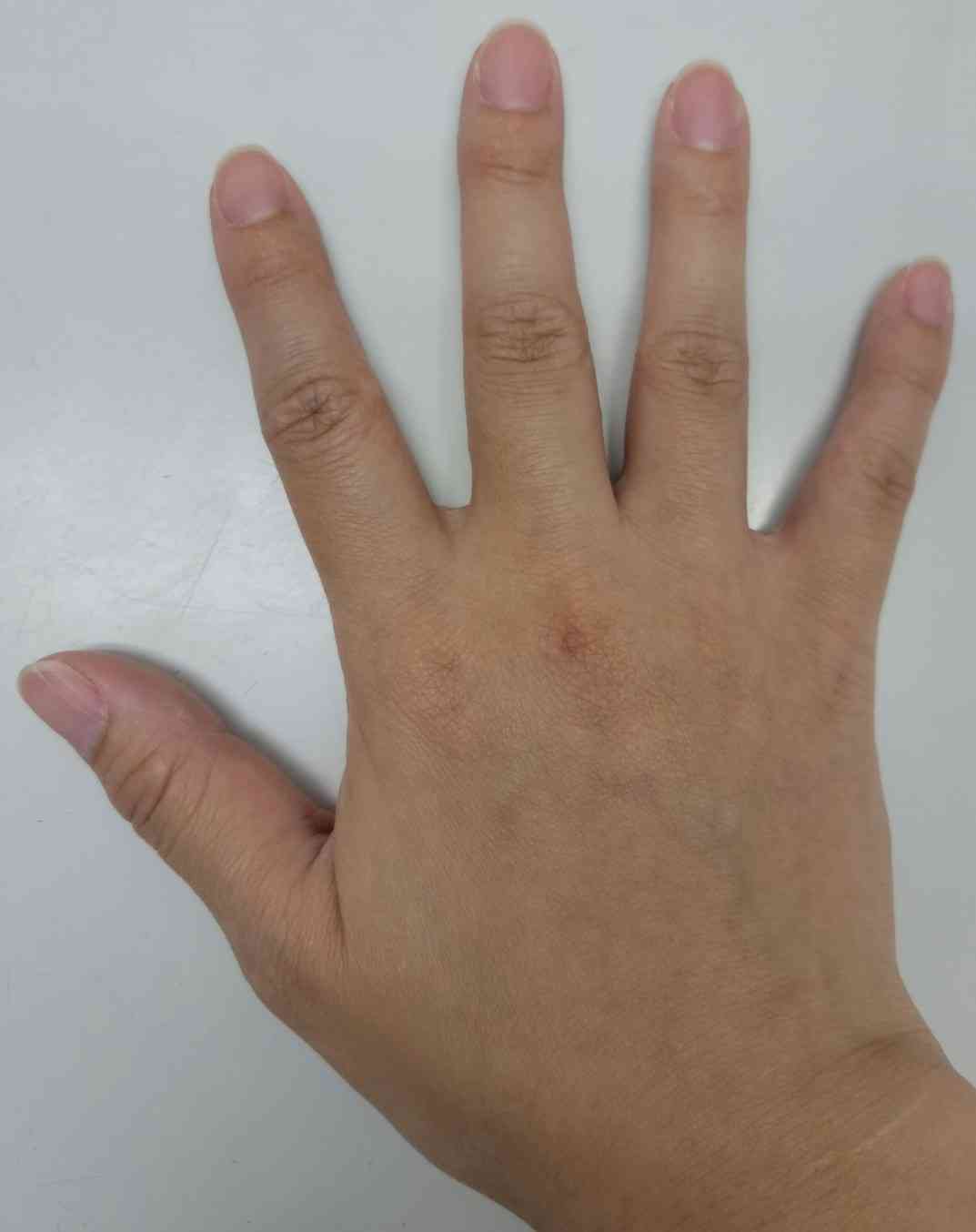 骨格診断をしてもらうトピ