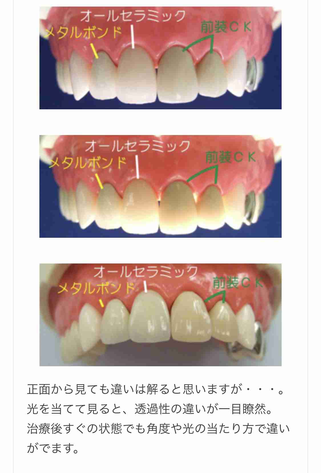 歯医者さんで働いてる人に聞きたいことpart5