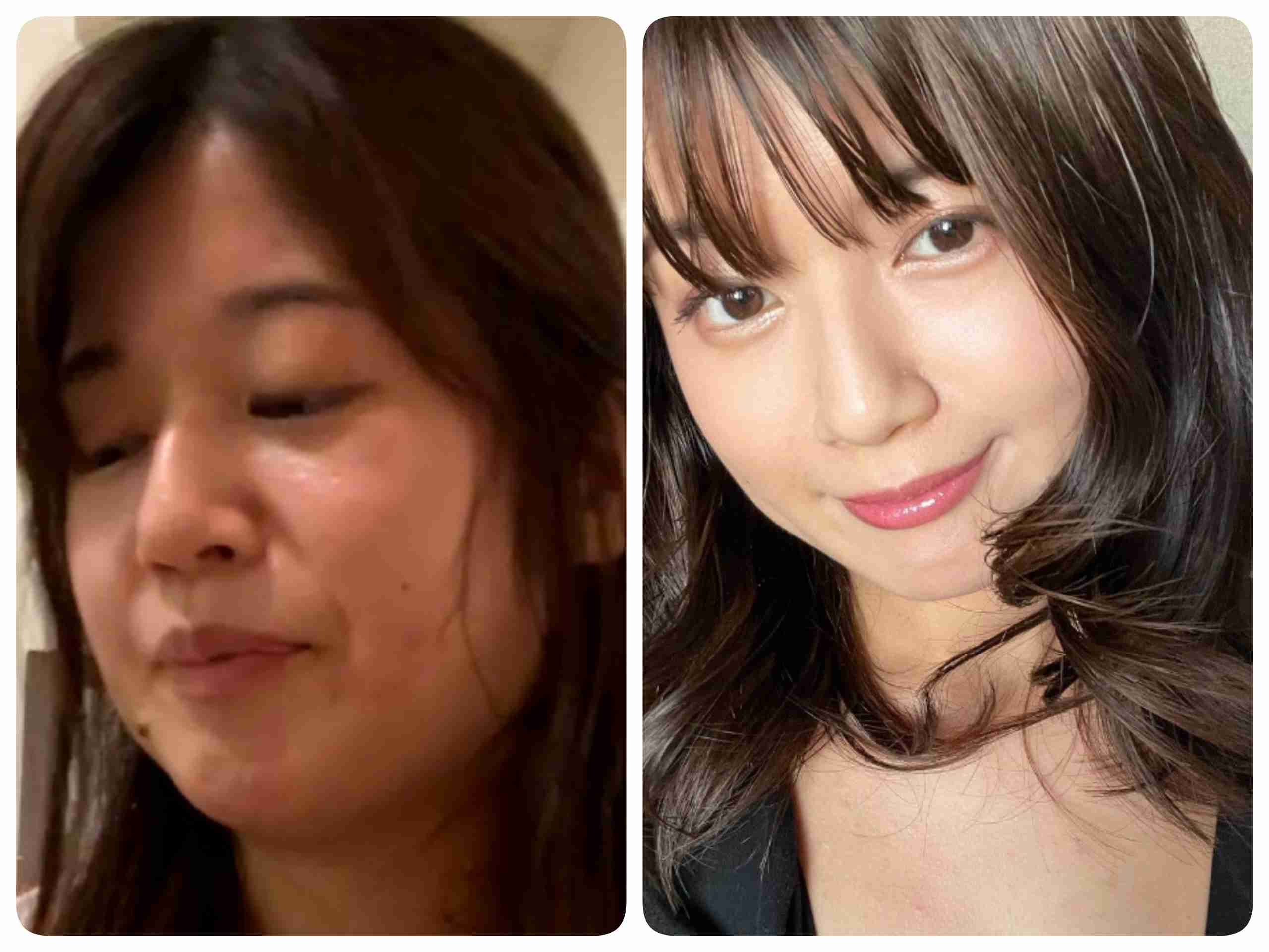 新潟・長岡在住の小林礼奈、歯科医院の少なさに不満「東京はコンビニの数ほどあるのに」「2週間待ちって…」