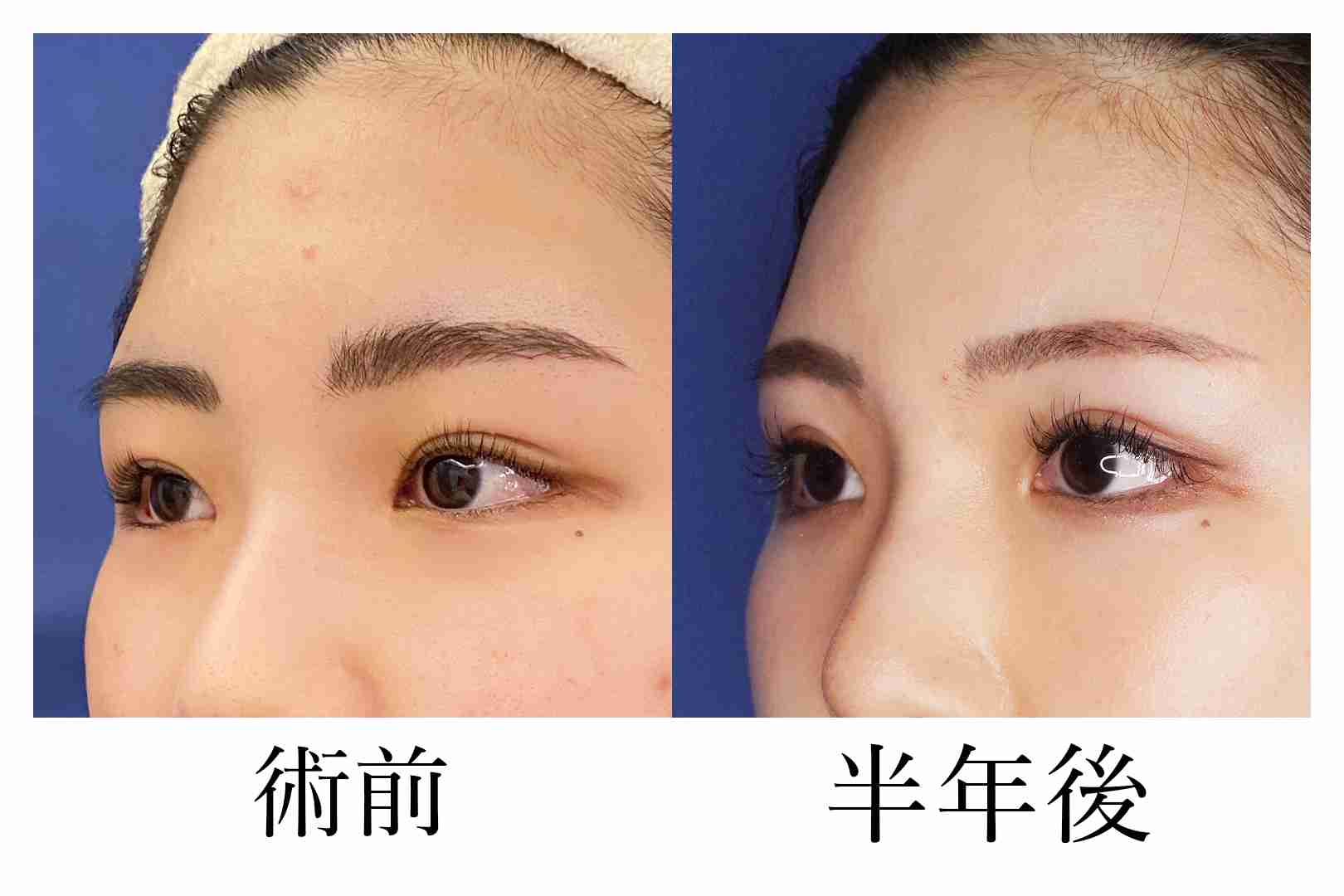 眉と目が離れてる人