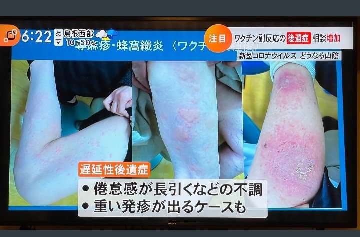 国民6割、ワクチン3回目完了 高齢者は9割近くに―政府