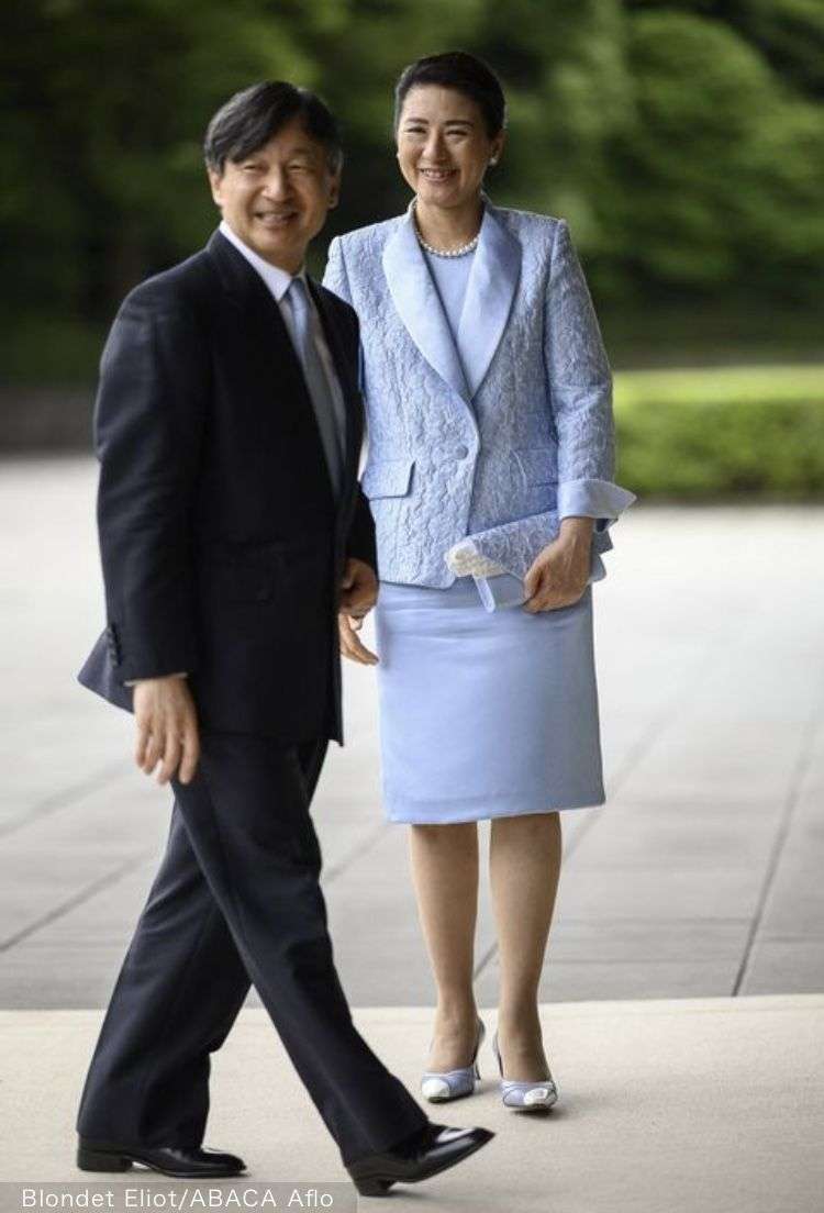 肩パットブームは再来すると思いますか?