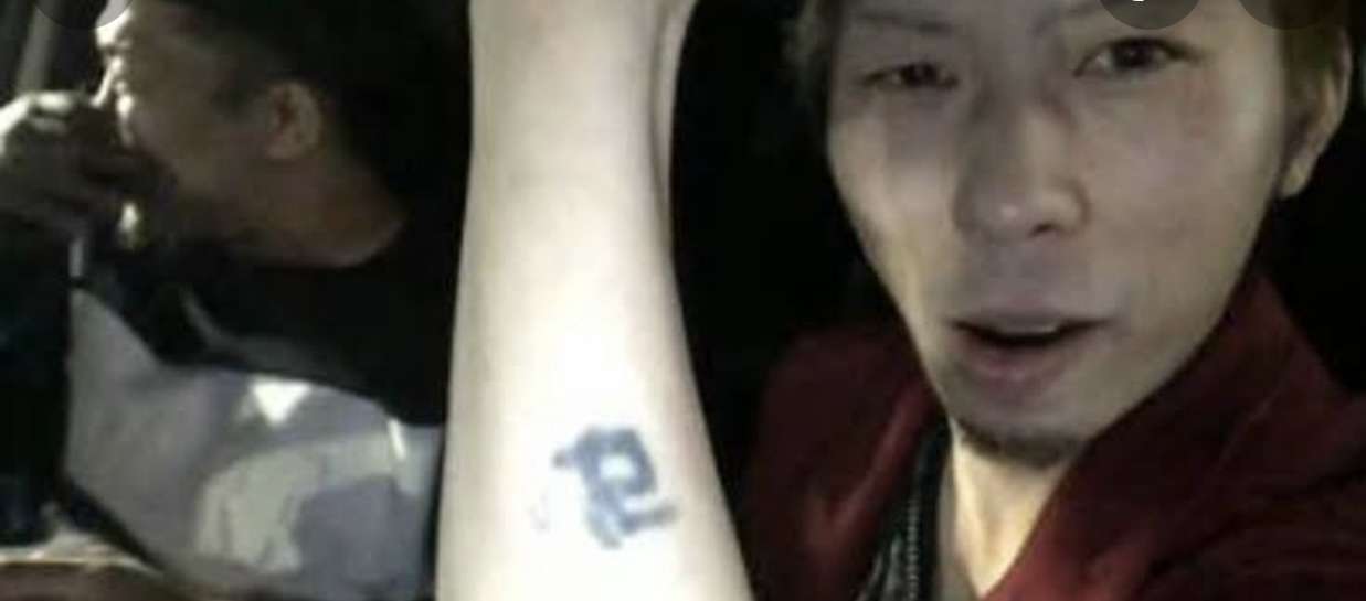 てんちむ「バチバチ痛い」３度目のタトゥー除去施術「足首はもうちょいかかりそう」