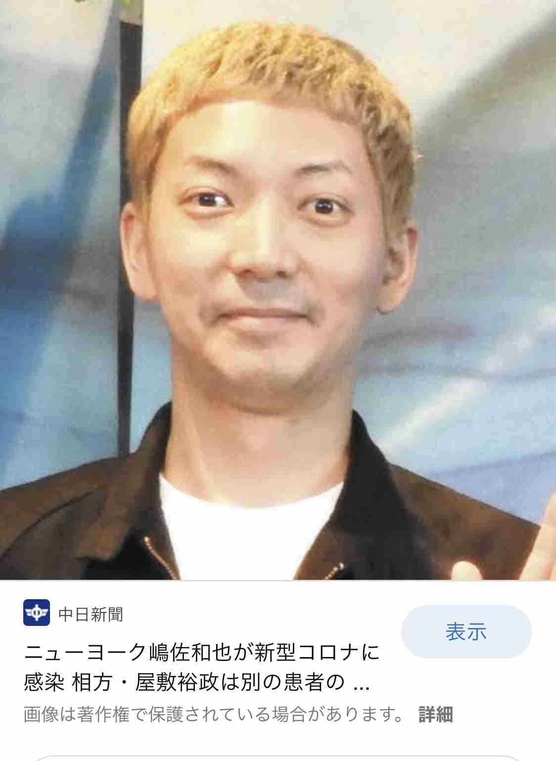 EXIT・りんたろー。　過去3年間の“課金顔”ビフォーアフター公開　美容医療で小顔に変化